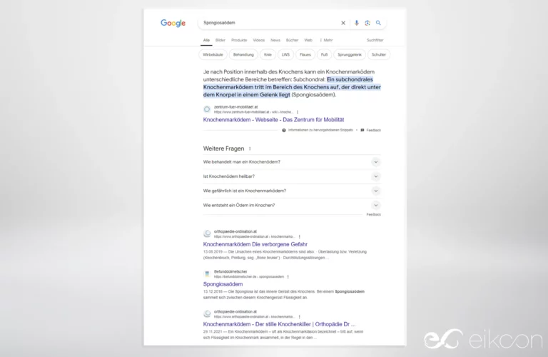 Dr. Gründler auf Platz 0 / Featured Snippet in Google für den Suchbegriff "Spongiosaödem"