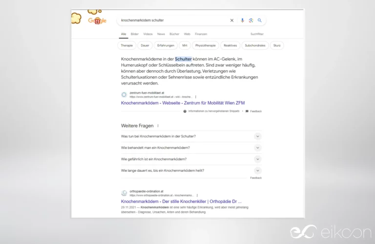 Dr. Gründler auf Platz 0 / Featured Snippet in Google für den Suchbegriff "Knochenmarködem Schulter"